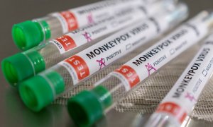 Tubos utilizados en los laboratorios etiquetados como "positivo en virus del mono"