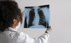 Una médico examina una radiografía de tórax (archivo)