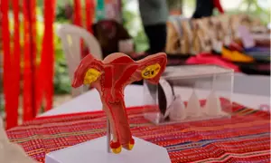 Fotografía de una campaña de cuidado menstrual.