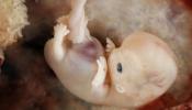 La placenta donde creciste nueve meses te pudo cambiar la vida