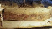 Encuentran el vestigio más antiguo de cáncer de mama en una momia egipcia