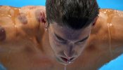 ¿Qué son las manchas rojas que Phelps luce en su hombro?