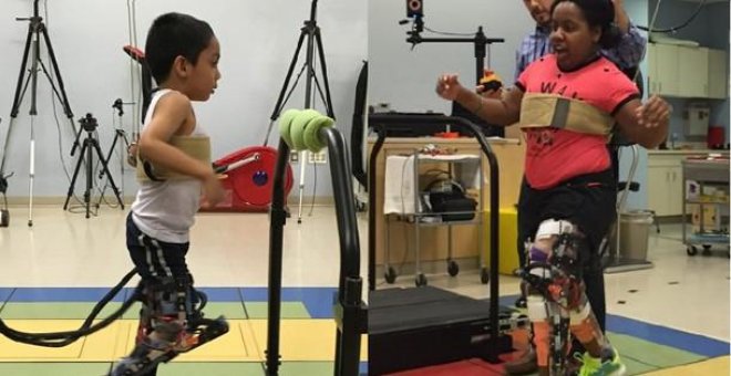 Una prótesis permite andar a niños con marcha agachada por parálisis cerebral