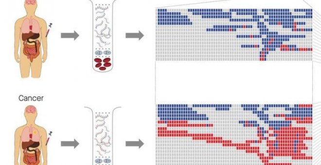 Avanza el análisis de sangre para detectar 50 tipos de cáncer
