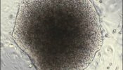 Nueva pieza en el puzzle celular de la biología de células madre y cáncer