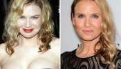 La increíble transformación de Renée Zellweger