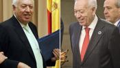Los 'ligues' de Margallo y las verdades sobre su liposucción