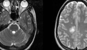 Localizada la zona del cerebro que regula la adicción