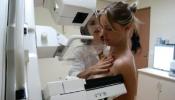 Dos fármacos reducen en un 34% las muertes en el cáncer de mama más agresivo