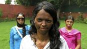 La India limita la venta de ácido para evitar los ataques contra las mujeres