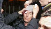 El exministro de Interior ucraniano recibe una paliza de los antidisturbios durante una protesta en Kiev