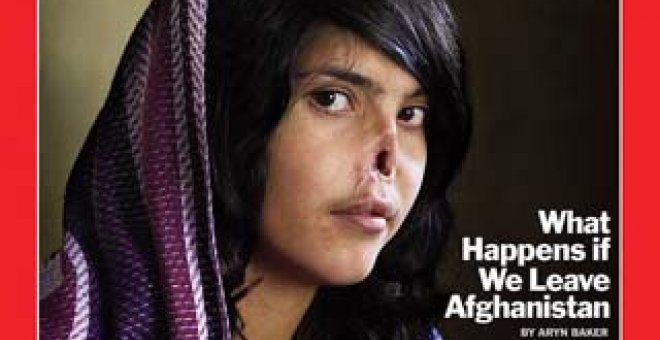La joven afgana mutilada se someterá a cirugía