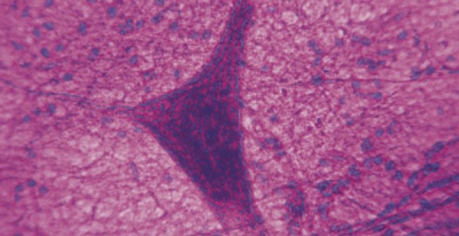 Neuronas nuevas para combatir el párkinson