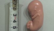 La Policía impide que un antiabortista entregue a Aído un feto de plástico