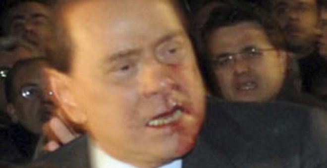 Berlusconi, hospitalizado tras ser agredido al final de un mitin