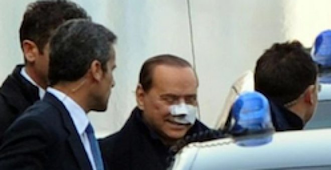 Berlusconi recibe el alta