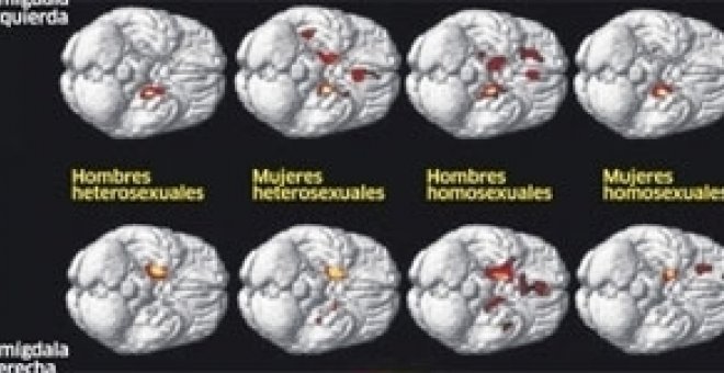 La orientación sexual se 've' en el cerebro