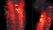 El sistema nervioso central de la larva de una mosca, en acción