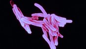 La nueva vacuna contra la tuberculosis muestra seguridad y respuesta inmunitaria en los ensayos