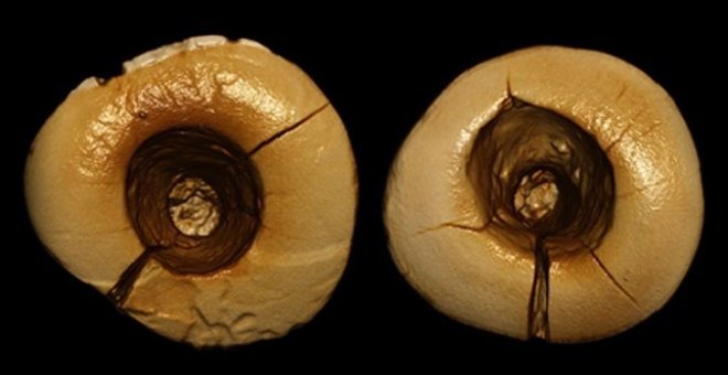 Investigadores encuentran evidencias de empastes dentales durante la Edad de Hielo