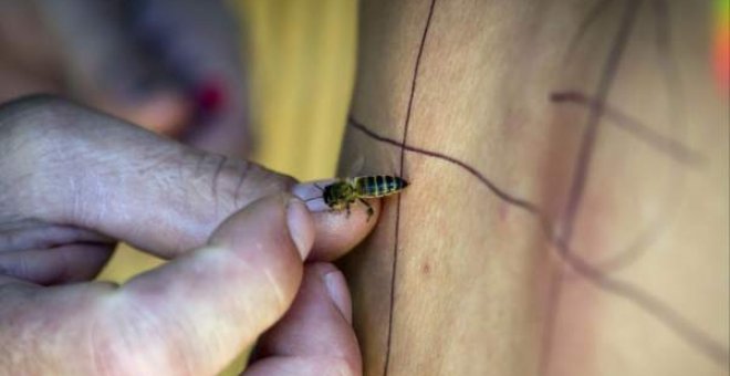 Una mujer española muere tras someterse a acupuntura con abejas