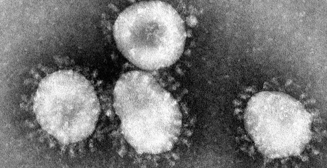 Un joven de 24 años que viajó a Italia, primer caso de coronavirus en Madrid: ya son cinco los contagiados en España