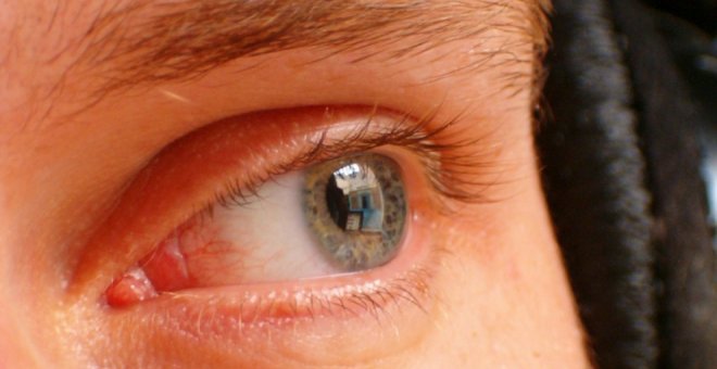 Cuida de la salud ocular: principales afecciones y remedios para tus ojos