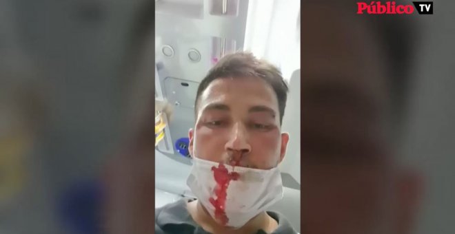 Un joven brasileño denuncia la agresión homófoba de un compañero de trabajo en Sanlúcar de Guadiana, Huelva