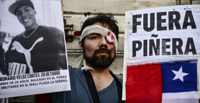 Consternación en Chile por el suicidio de un joven con trauma ocular por la violencia policial durante las protestas de 2019