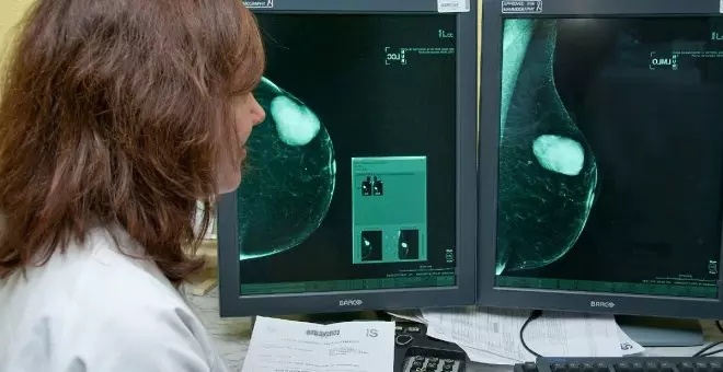 Tres de cada quatre pacients amb càncer de mama metastàtic podrien rebre una teràpia dirigida