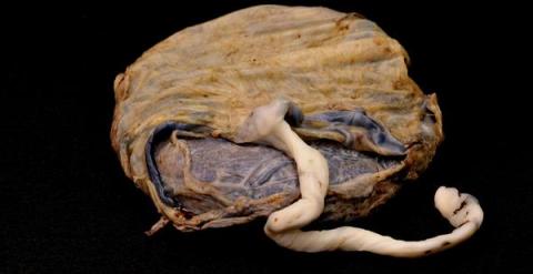 La placenta no es tan estéril como los científicos creían. Estudios recientes han recogido unos 300 tipos de bacterias, virus y hongos que la habitan y que pueden influir en la salud del futuro bebé. / lunar caustic