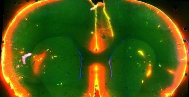 Micebrain: Imagen del cerebro de un ratón durante un estudio sobre la eliminación de toxinas.- UNIVERSITY OF ROCHESTER