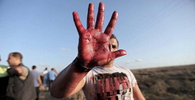 Un palestino muestra su mano manchada de sangre en la frontera este de Gaza. EFE