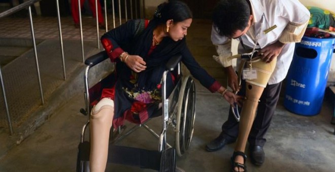 Rebeka, antigua trabajadora en el Rana Plaza, recibe la ayuda de un médico para colocarse sus prótesis. - AFP