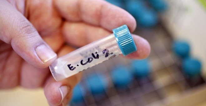 Un científico británico sostiene una muestra de una bacteria E.coli. REUTERS