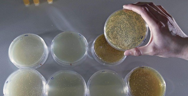 Una técnico de un laboratorio de microbiología sujeta una placa con una muestra de probióticos. EFE