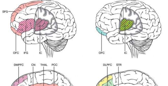 Diferencias y similitudes encontradas en las resonancias en áreas del cerebro asociadas a la depresión postparto, ansiedad y depresión mayor / Maayan Harel