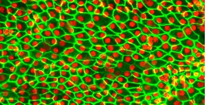 Células de la retina derivadas de células madre para su implantación. El perímetro de cada célula en verde y el núcleo en rojo. DENNIS CLEGG, UCSB