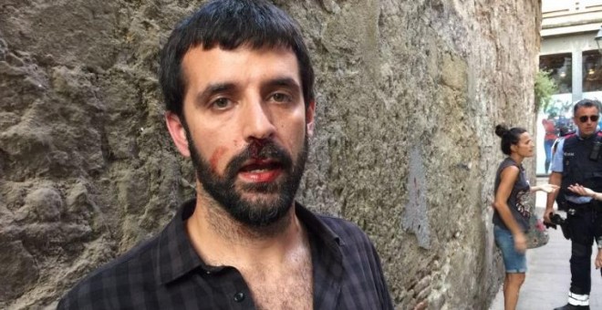 Jordi Borràs, después de la agresión. Imagen cedida por 'El Món'/QS