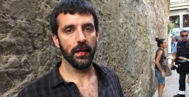 Jordi Borràs, después de la agresión. Imagen cedida por 'El Món'/QS