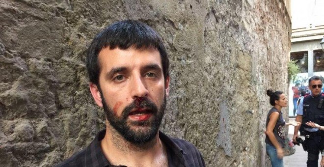 Jordi Borràs, después de la agresión. Imagen cedida por 'El Món'/QS
