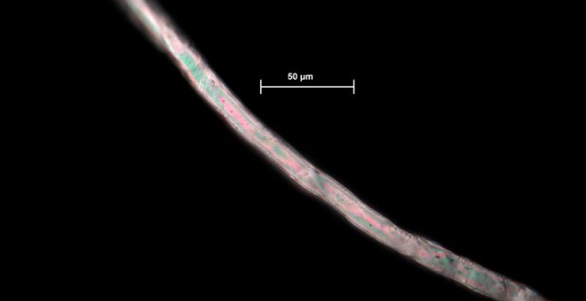 Microfibra de poliéster obtenida en los fondos marinos del océano Atlántico en un estudio similar. | Lucy Woodall / Museo de Historia Natural de Londres