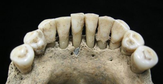 Pigmento de lapislázuli atrapado en el cálculo dental de la mandíbula inferior de una mujer medieval / Christina Warinner