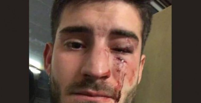 Un joven denuncia una agresión homófoba en el metro de Barcelona a través de su cuenta de Instagram. TWITTER/@ObservatoriLGTB
