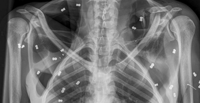 Radiografia del torso de la orangutana./EFE