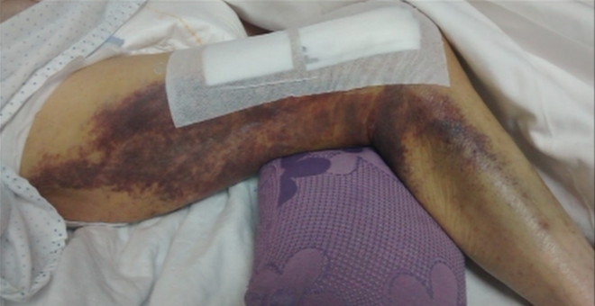 Imagen de la pierna de la anciana | Telemadrid