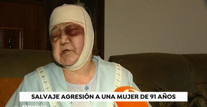 Valentina Sánchez, de 91 años, paseaba por la calle cuando un hombre, al que no conocía de nada, la atacó de forma violenta con una barra metálica./ ANTENA 3