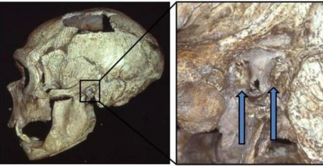 El cráneo de un hombre Neandertal con exóstosis (oído de nadador) / Erik Trinkaus