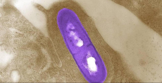Imagen microscópica de una bacteria Listeria monocytogenes | Reuters