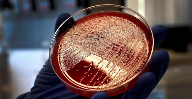 12/09/2019.- Vista de un cultivo de listeriosis en una placa de Petri, este jueves en el Laboratorio de Listeriosis del Centro Nacional de Microbiología de Madrid. Investigadores del Centro Nacional de Microbiología (CNM) han confirmado que una misma cepa